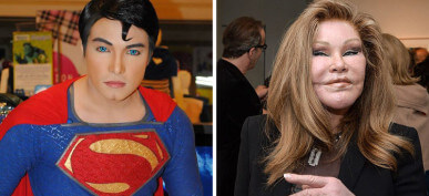 30+ People Who Took Plastic Surgery To The Extreme