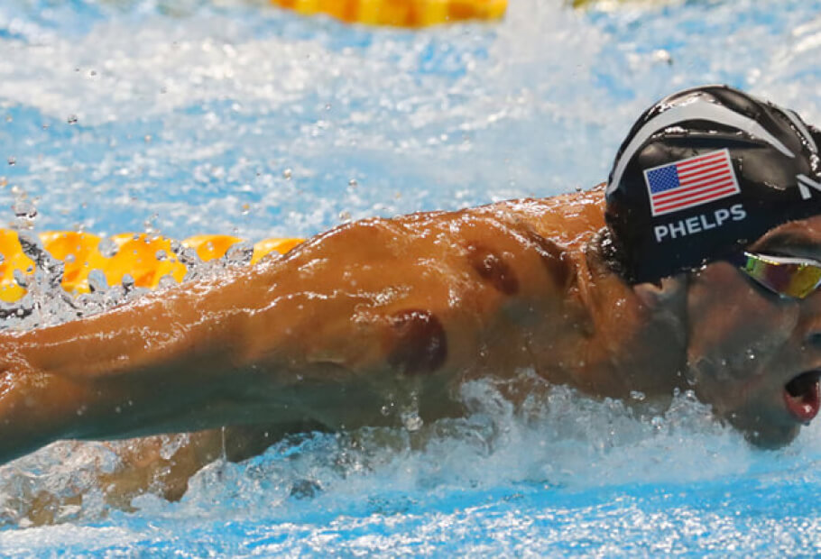 3 Olympische Medaillengewinner, die die ganze Welt bewundert
