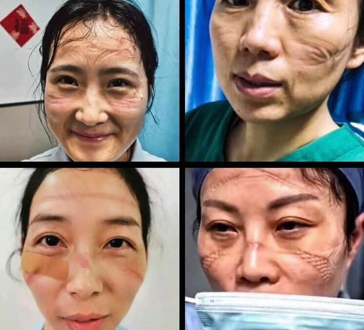 Wuhan Nurses Share Photos Post-Coronavirus Shifts