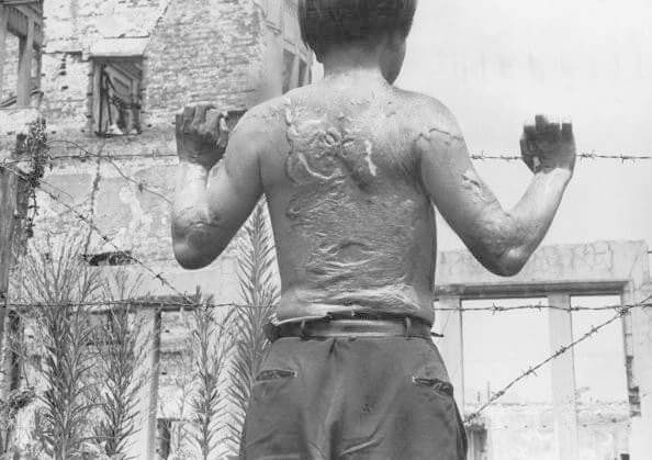 Hiroshima Victim