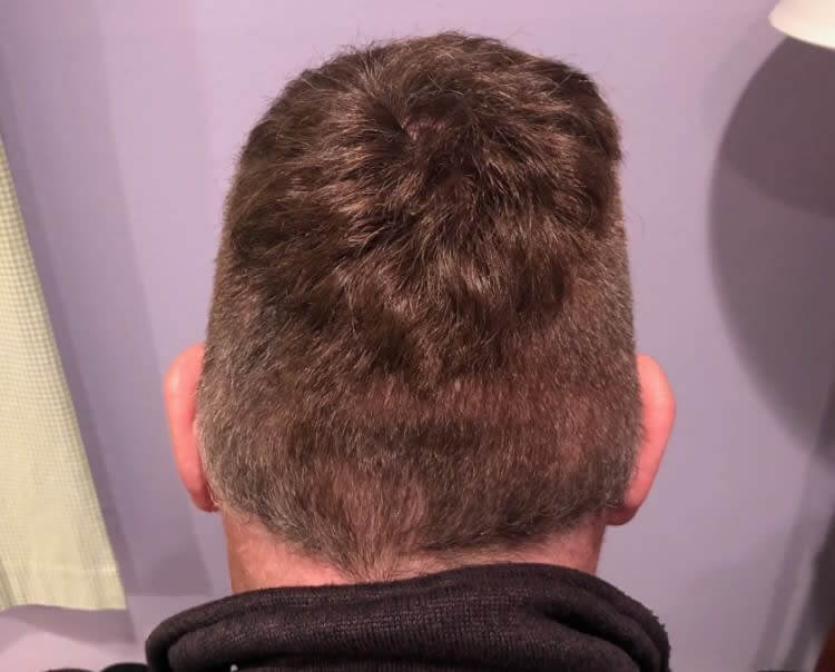 "Just Leave The Top Long"