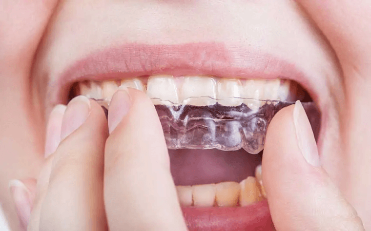 Use It To Disinfect Retainers