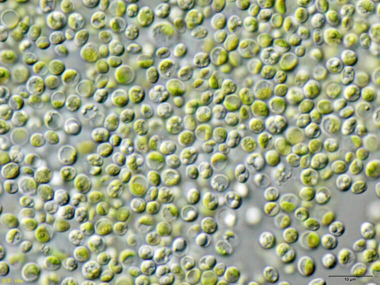 Chlorella: The Single-Celled Algae for Gentle Heavy Metal Detox