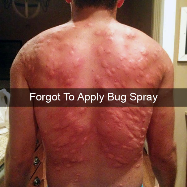 The Level Of Itchiness On His Back Is Unreal