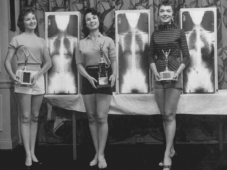 Der Miss-Korrekte-Haltung-Wettbewerb