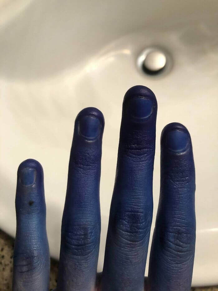 This Person Who Put The Hair Dye Gloves Backwards