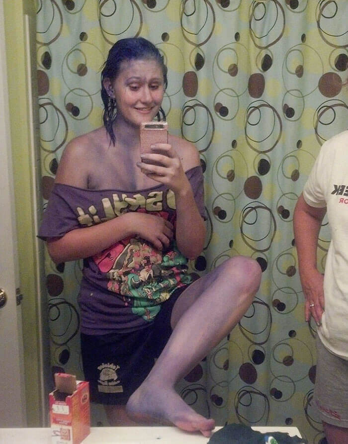 When Hair Dye Bleeds All Over Your Body