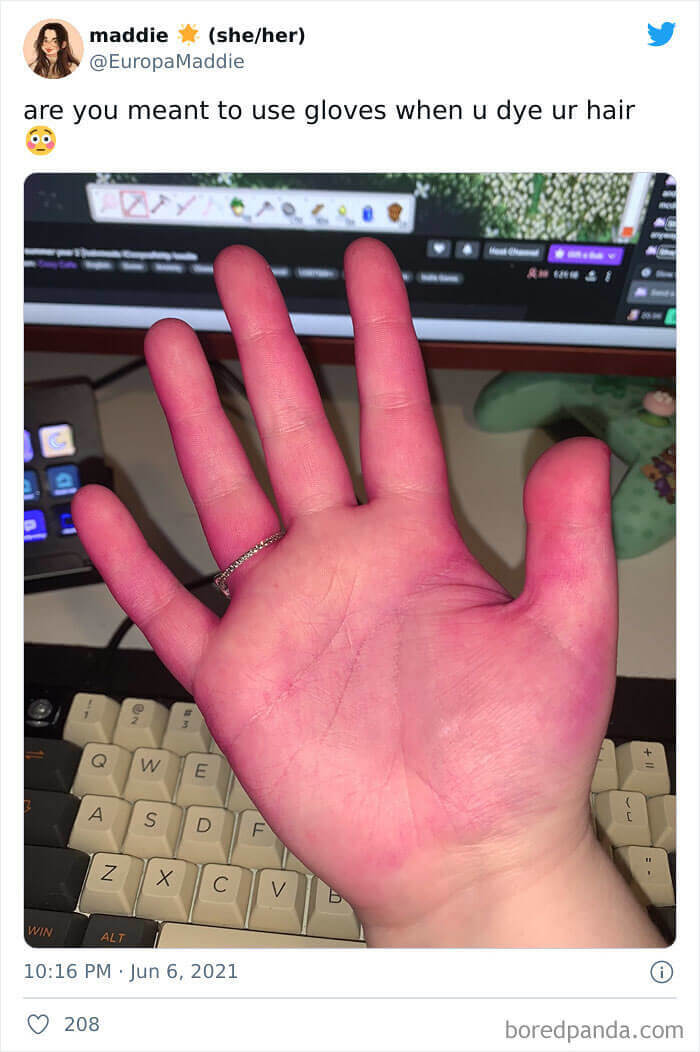 This Person Who Had No Idea They Needed To Wear Gloves