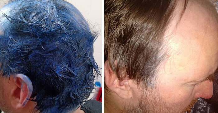 A Hair That Is Resistant To Dyeing