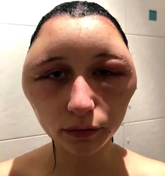 Always Test Your Hair Dye Before Using It