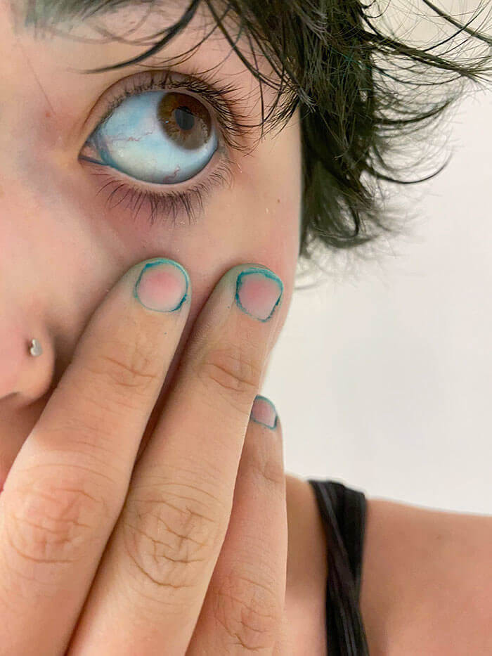 This Person Managed To Dye Her Corneas