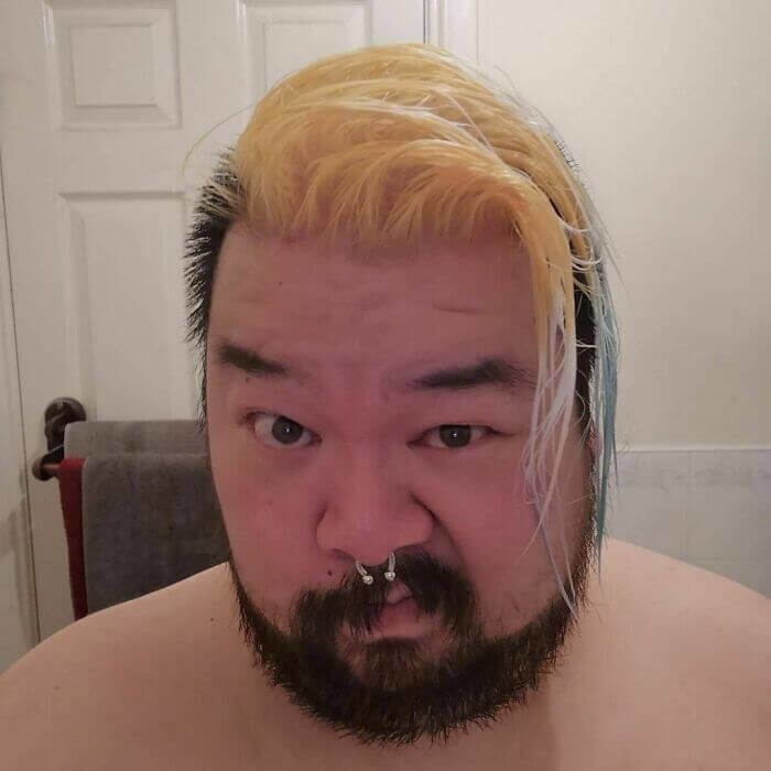 This Guy Burned A Huge Part Of His Hair