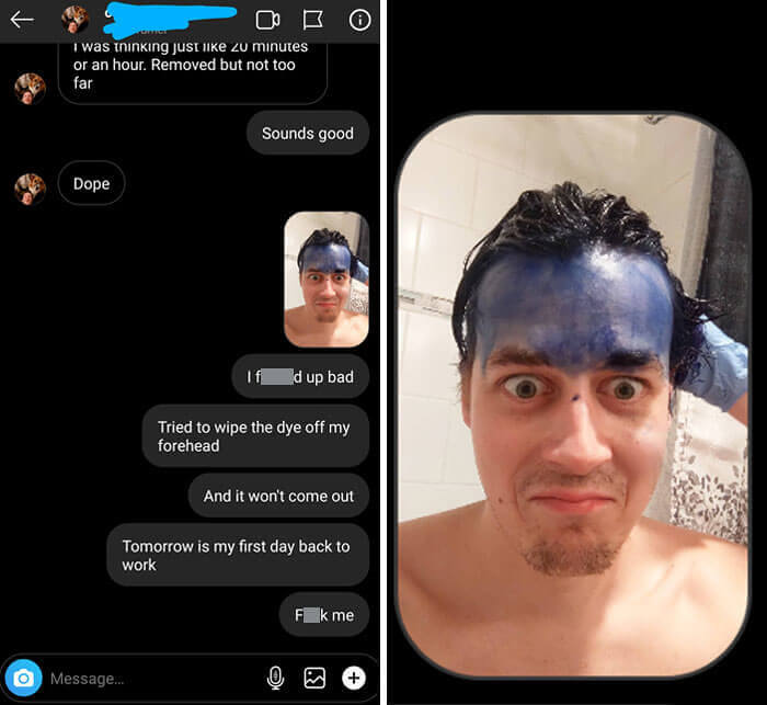 This Guy Who Smudged Dye On His Forehead