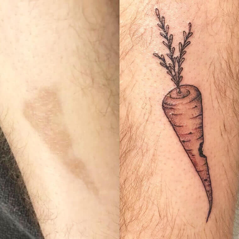 The Tattoo Artist Noticed Something About The Birthmark's Shape