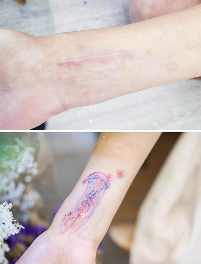 When A Jellyfish Complements The Scar