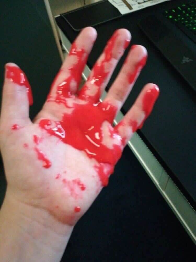 Stress Ball Explosion