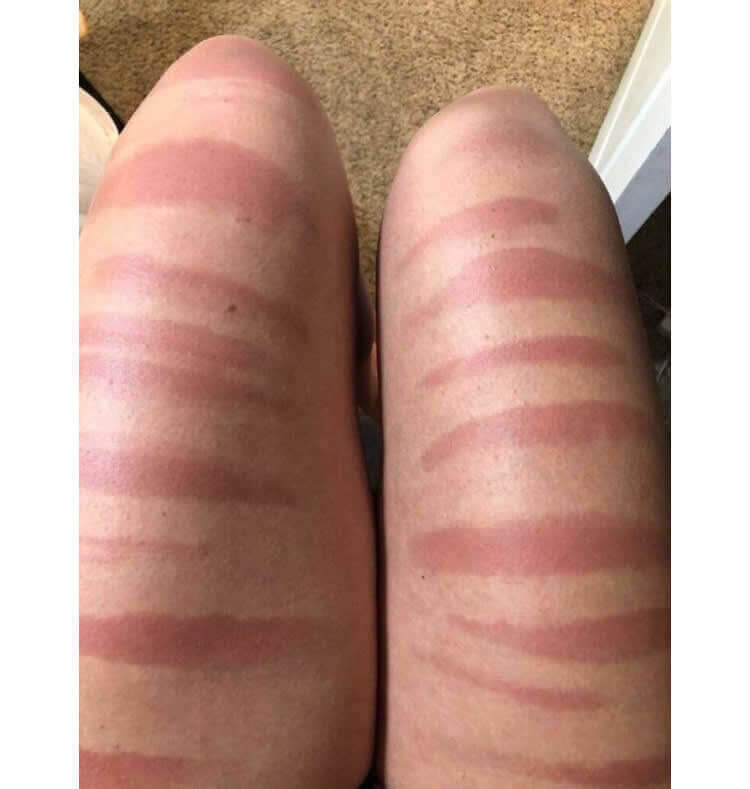 New Trend of Tanning?