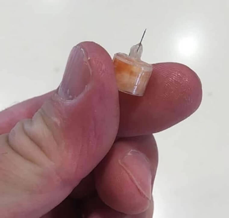 Do You NEEDLE a Burger Now?