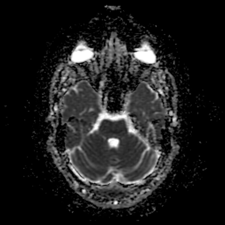 Your Brain Is More Active at Night Than During the Day