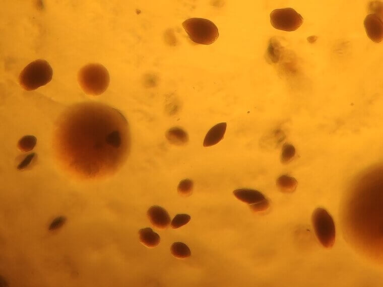 You Are Carrying Around About Three Pounds of Bacteria