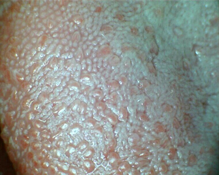 Your Taste Buds Are Replaced Every Two Weeks