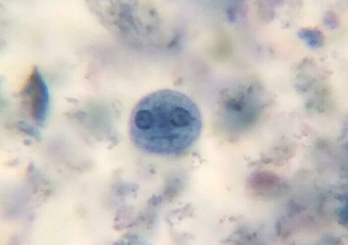 Isso é uma ameba, não um rosto sorridente