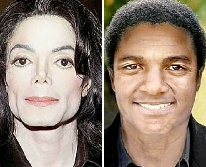 Um retrato gráfico do verdadeiro rosto do Michael Jackson