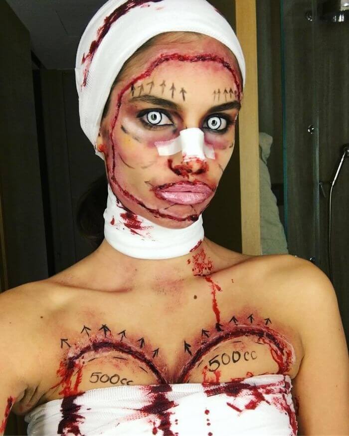 Sara Sampaio Looks Botched As A Plastic Surgery Patient