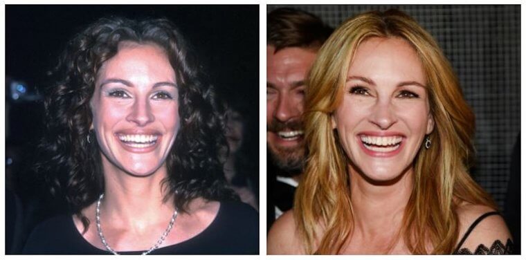 Julia Roberts - 1999 Vs. 2016 (17 Year Difference)