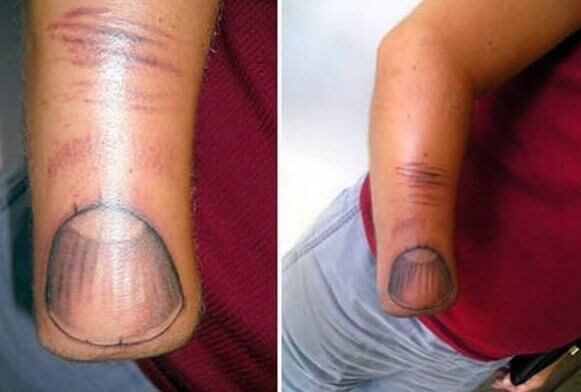 Ever Seen an Arm-Sized Thumb?