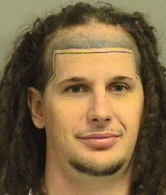 A Quirky Fix for a Receding Hairline