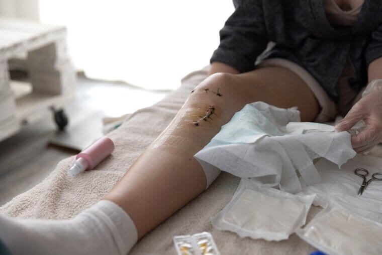 ACL Reconstruction: A Knee’s Long Road