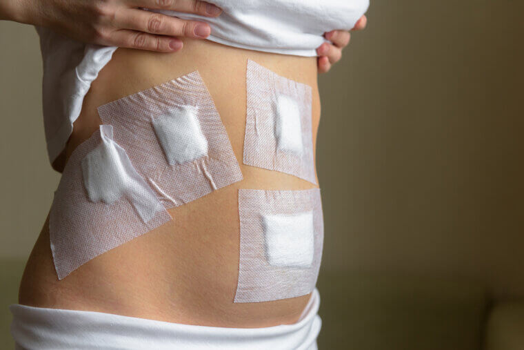 Abdominal Wall Reconstruction: A Core Conflict