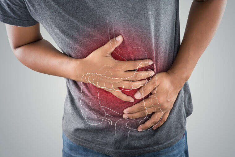 Proctocolectomy: A Major System Reset