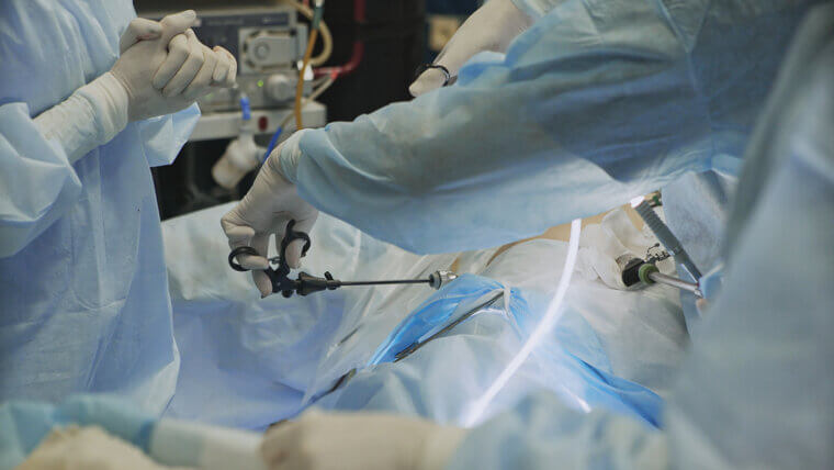 Gallbladder Removal: The Cholecystectomy Ache