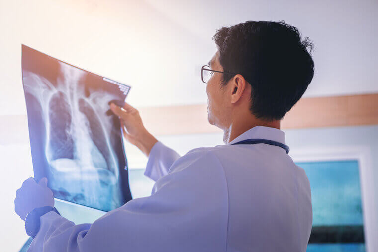 Thoracic Surgery: The Difficulty of Deep Breaths