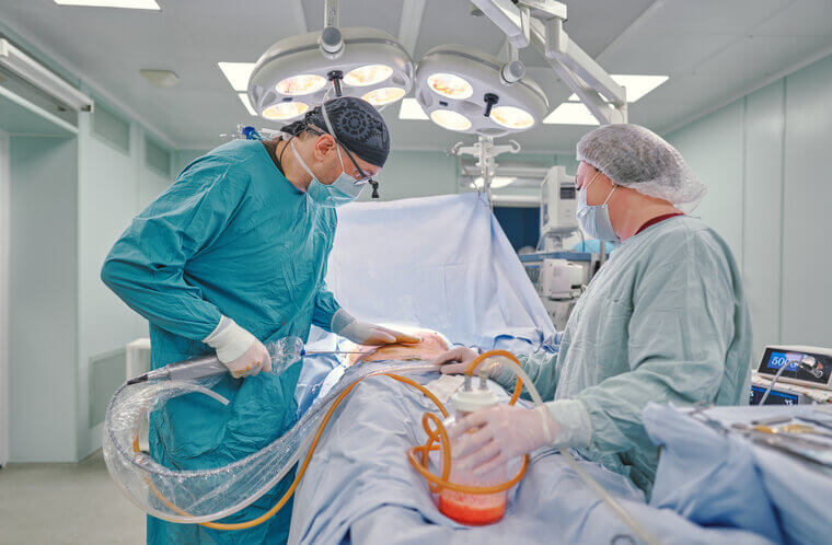 Liposuction: The Full-Body Bruise