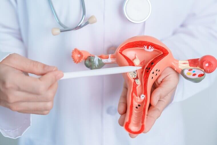 Hysterectomy: A Significant Shift