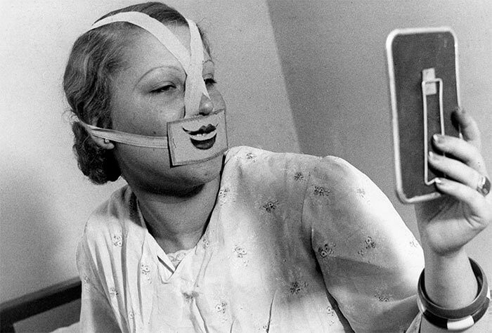 1930s Woman Undergoing "Smile Therapy"