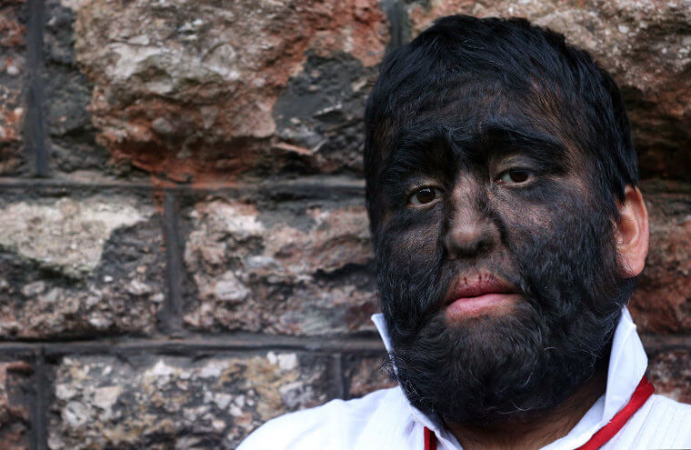 The Proud Father of the Largest Hairy Family