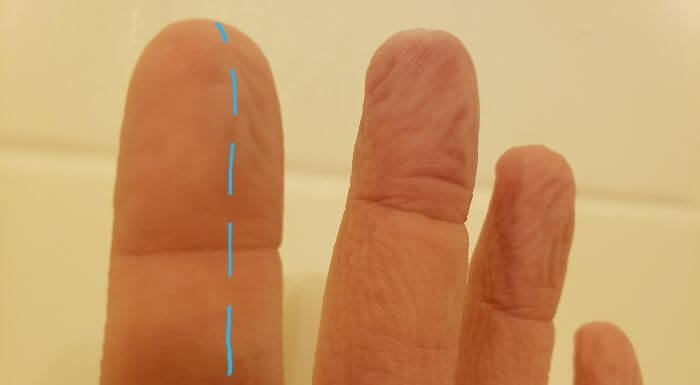 When You Spend A Lot Of Time In The Water And Your Index Finger Has A Severed Nerve