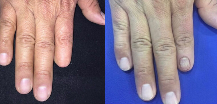 Gustavo The Finger Magician