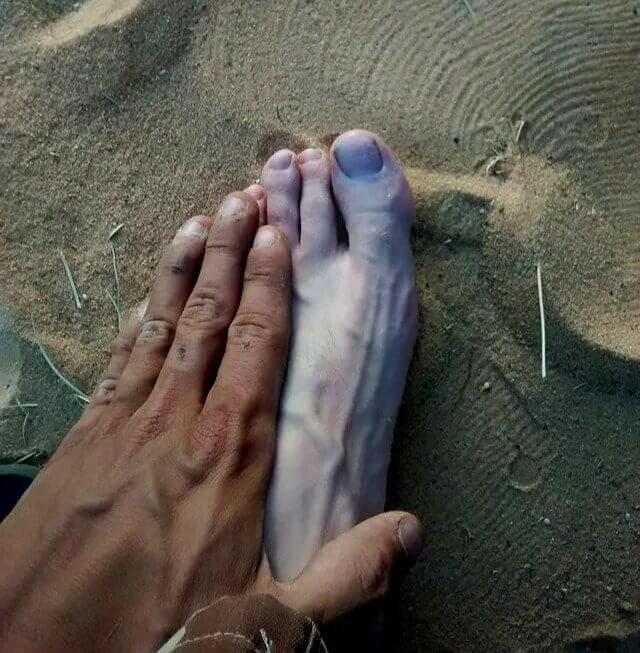 Same Person, Different Limbs