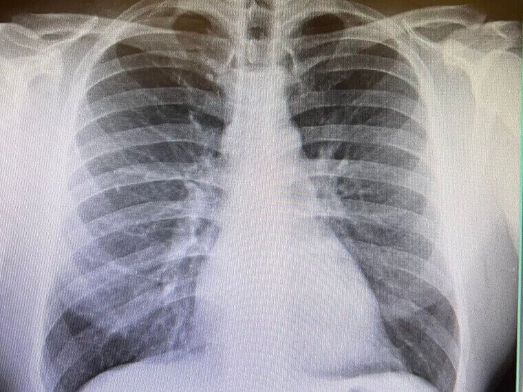 Radiologic Technologists