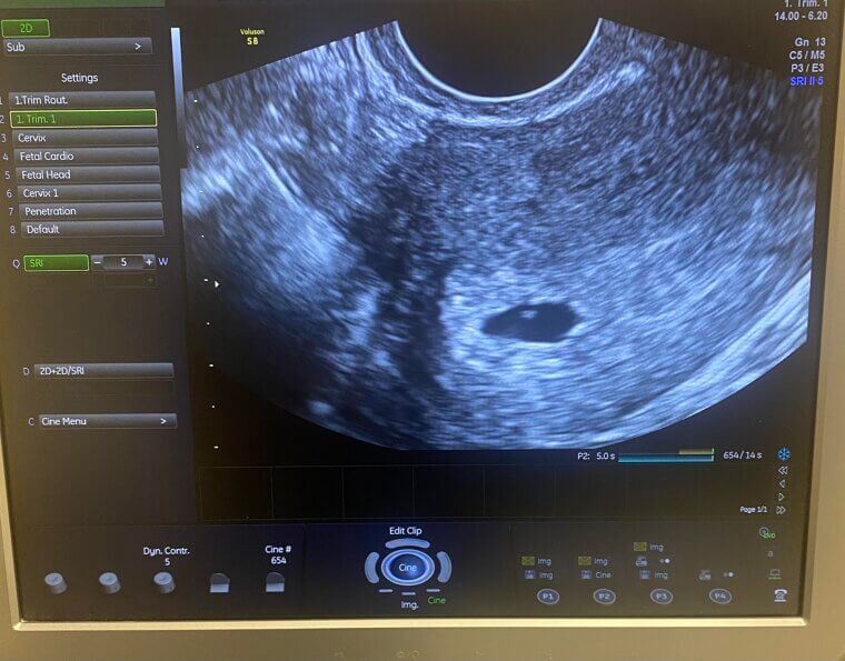 Diagnostic Medical Sonographers