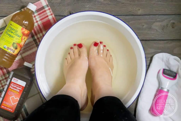 Use Hydrogen Peroxide In Foot Soaks