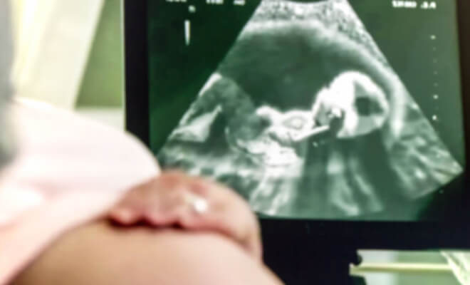 The Fascinating Story of the McGhee Sextuplets