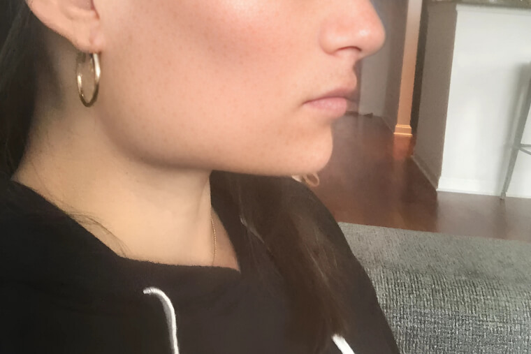 Clenching Your Jaw or Grinding Teeth