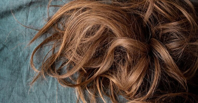 Hair Loss or Thinning