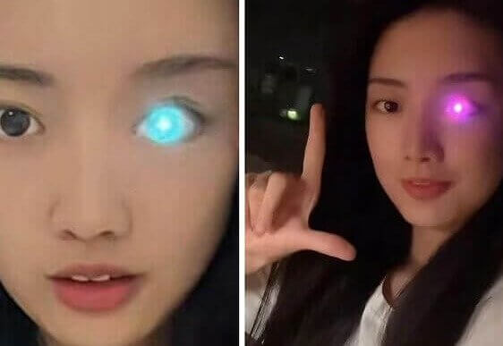 A Woman Lost Her Eye, Then Got One That Glows